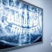 AI Dental Diagnostics Miami 2026: Transparency & Implant Costs